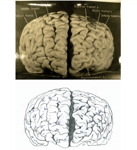 Einstein's brain, front view